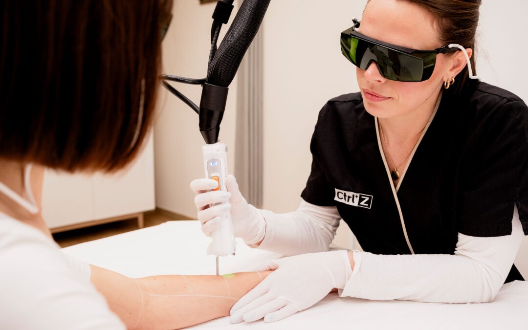 What preparation is required before a laser hair removal session?