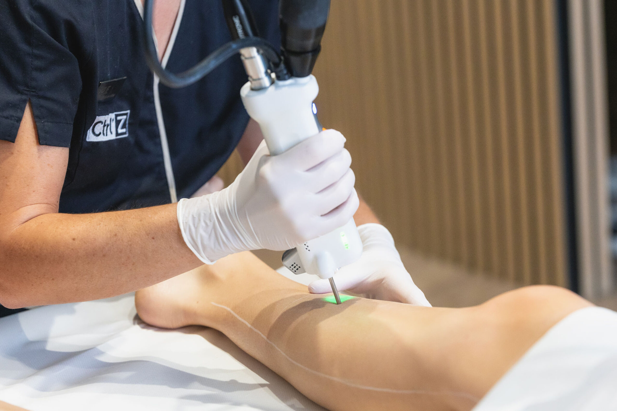 epilation laser des jambes