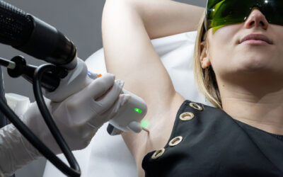 Epilation laser aisselles : tarifs, nombre de séances et résultats durables