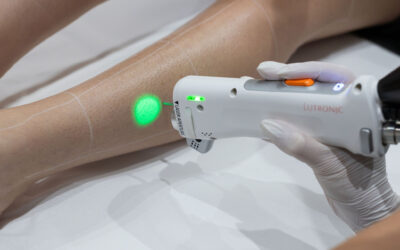 Épilation laser diode : comparatif avec la lumière pulsée et les lasers médicaux