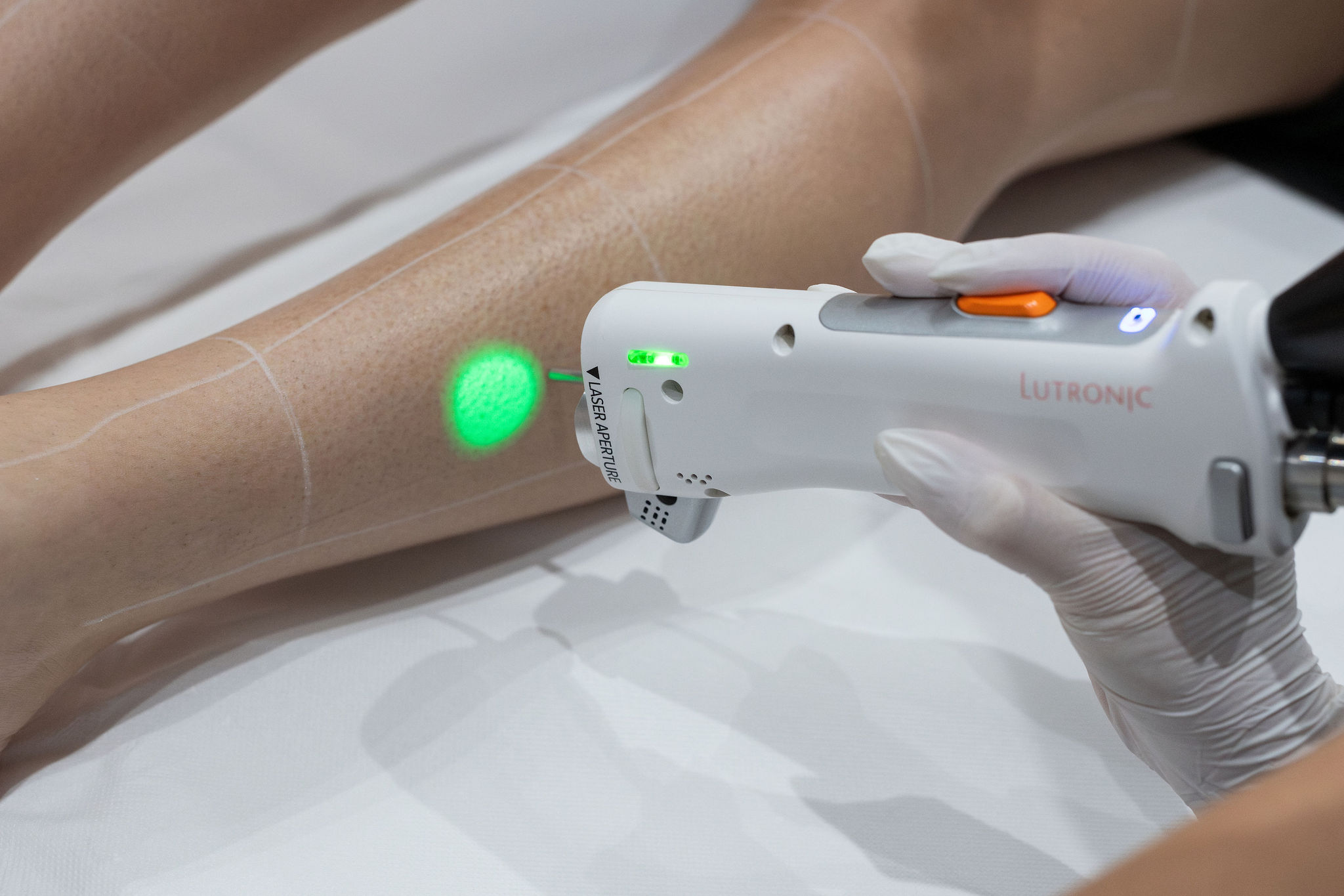 epilation laser diode