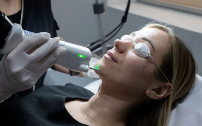 Épilation laser menton : prix, témoignages & séances