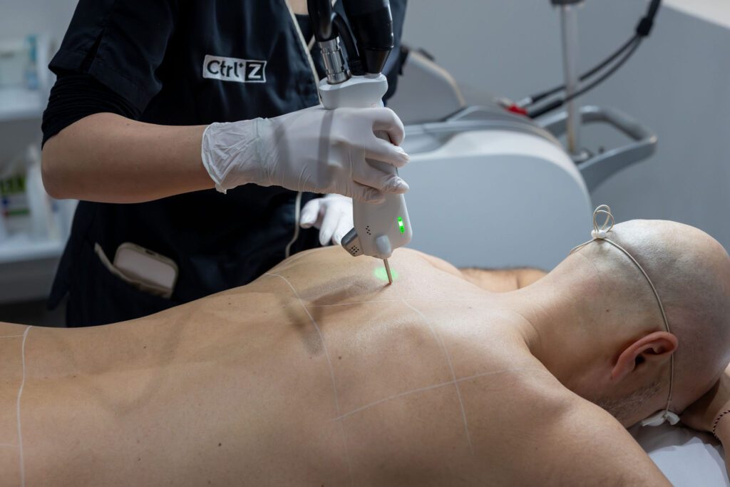 epilation laser dos