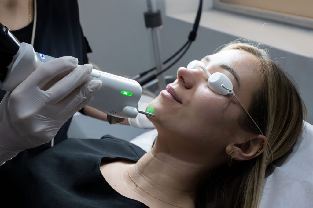 epilation laser menton