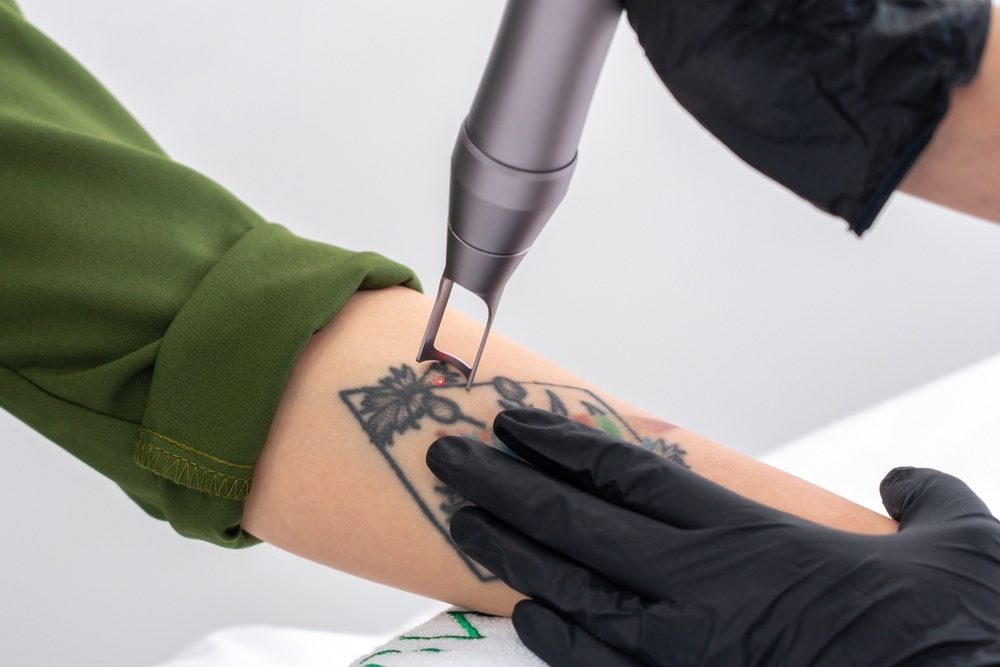 detatoauge s'efface de manière inégale
